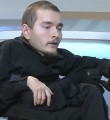 Валерий Спиридонов Пересадка головы